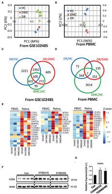 Diabetes Promotes Retinal Vascular Endothelial Cell Injury by Inducing CCN1 Expression